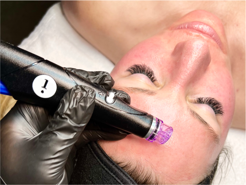 HydraFacial Deluxe Services: Deeply cleanses, exfoliates, and hydrates for smooth, glowing skin.