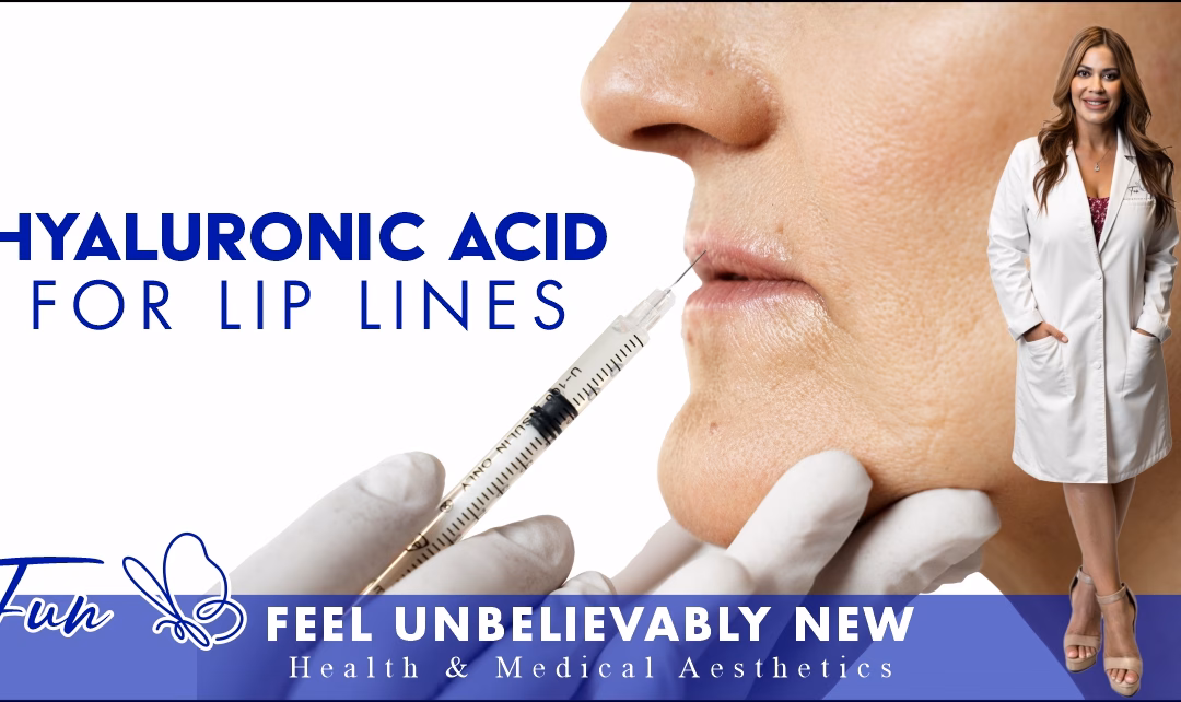 Woman smiling with smooth lips after hyaluronic acid gel treatment at Fun By Michelle